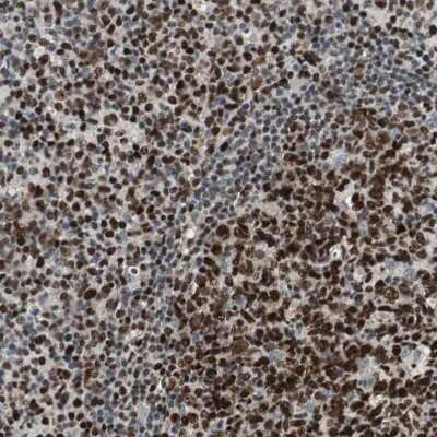 Immunohistochemistry-Paraffin: FEN-1 Antibody [NBP1-84697]