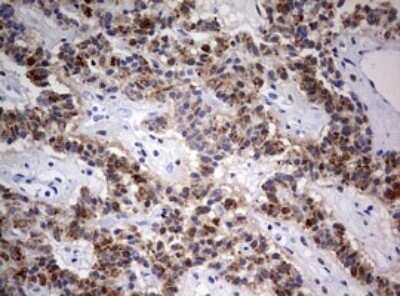 Immunohistochemistry: FEN-1 Antibody (OTI1F3) - Azide and BSA Free [NBP2-70716]