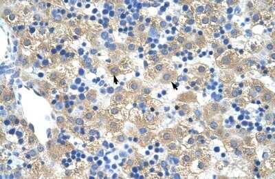 Immunohistochemistry-Paraffin: FERD3L Antibody [NBP1-80169]
