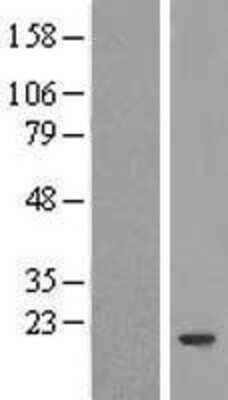Western Blot: FERD3L Overexpression Lysate [NBP2-05303]
