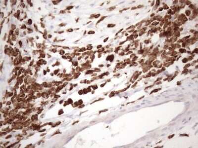 Immunohistochemistry: FERMT3/URP2 Antibody (OTI3C7) [NBP2-45641]