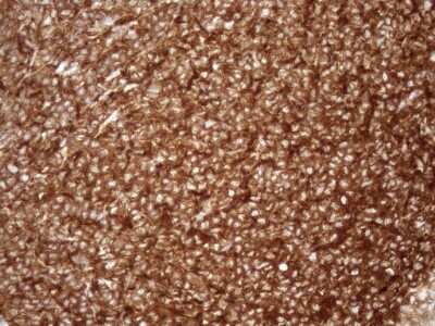 Immunohistochemistry: FERMT3/URP2 Antibody (OTI3C7) [NBP2-45641]