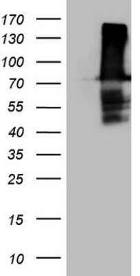 Western Blot: FERMT3/URP2 Antibody (OTI3C7) [NBP2-45641]