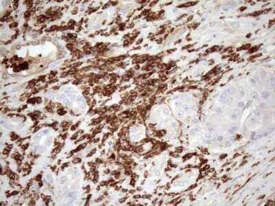 Immunohistochemistry: FERMT3/URP2 Antibody (OTI3C7) - Azide and BSA Free [NBP2-72241]