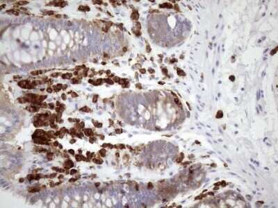 Immunohistochemistry: FERMT3/URP2 Antibody (OTI3C7) - Azide and BSA Free [NBP2-72241]