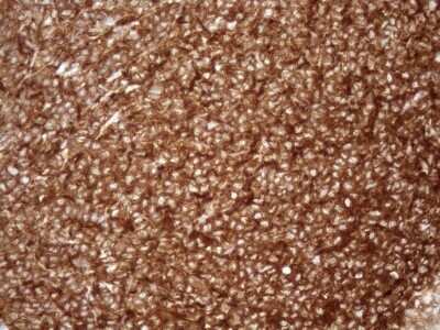 Immunohistochemistry: FERMT3/URP2 Antibody (OTI3C7) - Azide and BSA Free [NBP2-72241]