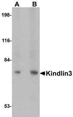Western Blot: FERMT3/URP2 AntibodyBSA Free [NBP1-76349]