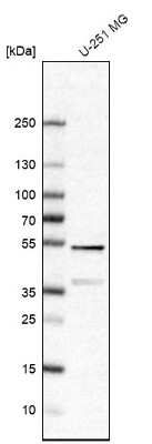 Western Blot: FEZ2 Antibody [NBP1-90909]