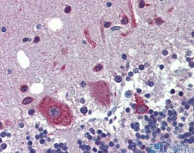 Immunohistochemistry: FEZF1 Antibody [NBP1-91367]