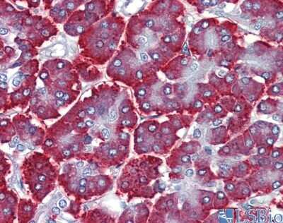 Immunohistochemistry: FEZF1 Antibody [NBP1-91367]