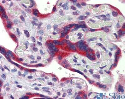 Immunohistochemistry: FEZF1 Antibody [NBP1-91367]