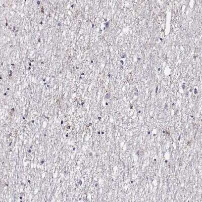 Immunohistochemistry-Paraffin: FEZF1 Antibody [NBP2-57999]