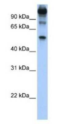 Western Blot: FEZF1 Antibody [NBP1-91367]