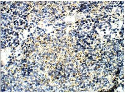Immunohistochemistry-Paraffin: FFAR2/GPR43 Antibody [NBP3-12190]