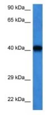 Western Blot: FFAR2/GPR43 Antibody [NBP3-09449]
