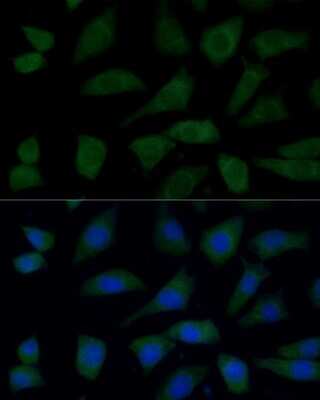 Immunocytochemistry/ Immunofluorescence: FGD1 Antibody - Azide and BSA Free [NBP3-03966]