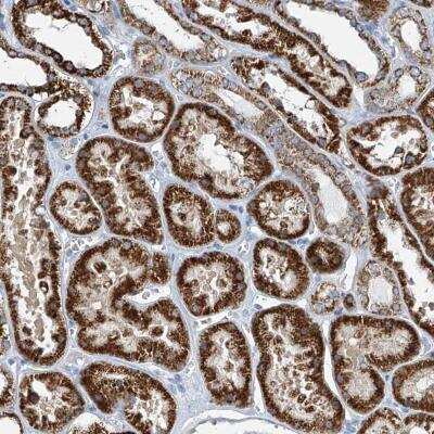 Immunohistochemistry-Paraffin: FGD2 Antibody [NBP1-80600]