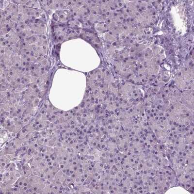 Immunohistochemistry-Paraffin: FGF-11 Antibody [NBP2-62694]