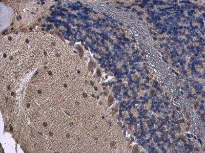 Immunohistochemistry-Paraffin: FGF-13 Antibody [NBP2-16471]