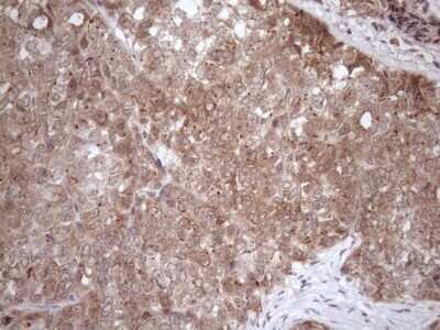 Immunohistochemistry: FGF-13 Antibody (OTI7E8) - Azide and BSA Free [NBP2-70721]