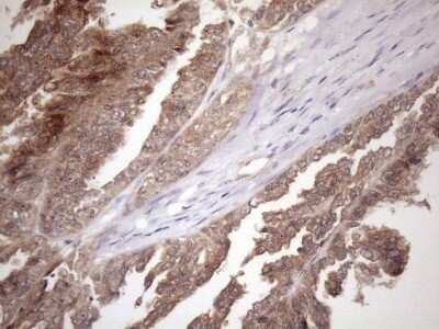 Immunohistochemistry: FGF-13 Antibody (OTI7E8) - Azide and BSA Free [NBP2-70721]