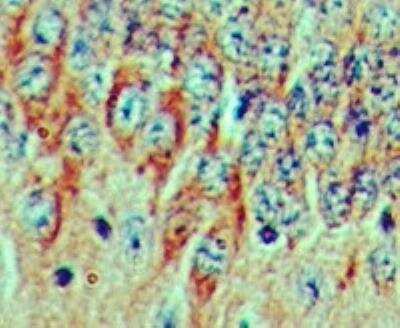 Immunohistochemistry-Paraffin: FGF-20 Antibody [NBP2-27114]