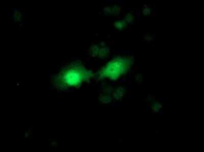 Immunocytochemistry/ Immunofluorescence: FGF-21 Antibody (OTI2F10) - Azide and BSA Free [NBP2-71815]