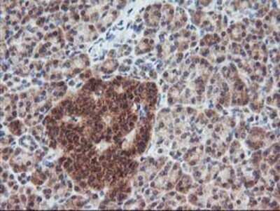 Immunohistochemistry: FGF-21 Antibody (OTI2F10) - Azide and BSA Free [NBP2-71815]
