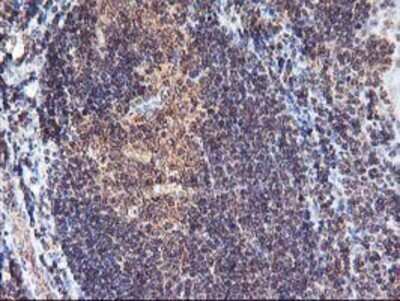 Immunohistochemistry: FGF-21 Antibody (OTI2F10) - Azide and BSA Free [NBP2-71815]