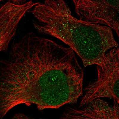 Immunocytochemistry/ Immunofluorescence: FGF-5 Antibody [NBP2-59013]