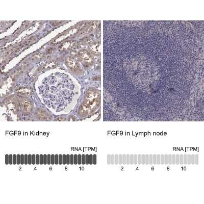 Immunohistochemistry-Paraffin: FGF-9 Antibody [NBP2-62653]