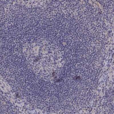 Immunohistochemistry-Paraffin: FGF-9 Antibody [NBP2-62653]