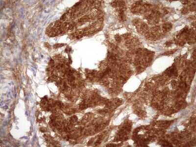Immunohistochemistry-Paraffin: FGF-BP Antibody (OTI2B6) [NBP2-45643]