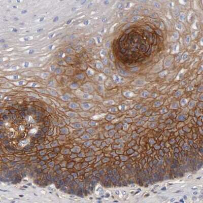 Immunohistochemistry-Paraffin: FGF-BP Antibody [NBP1-83904]