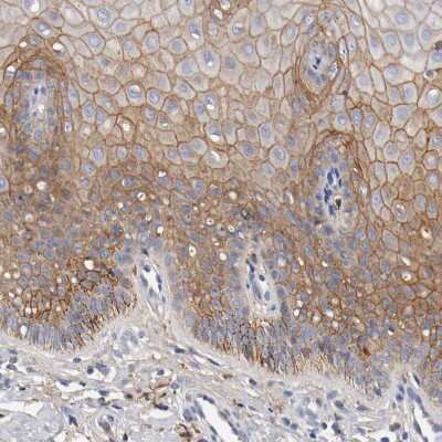 Immunohistochemistry-Paraffin: FGF-BP Antibody [NBP1-83904]