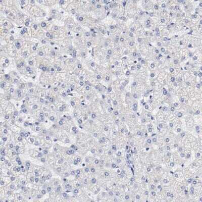 Immunohistochemistry-Paraffin: FGF-BP Antibody [NBP1-83904]