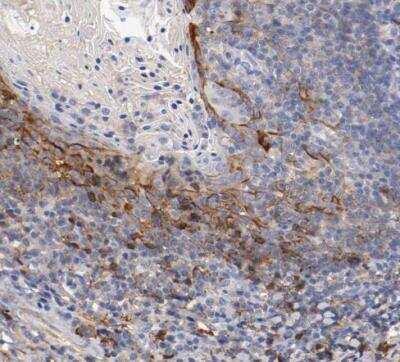 Immunohistochemistry-Paraffin: FGF-BP Antibody [NBP1-83904]