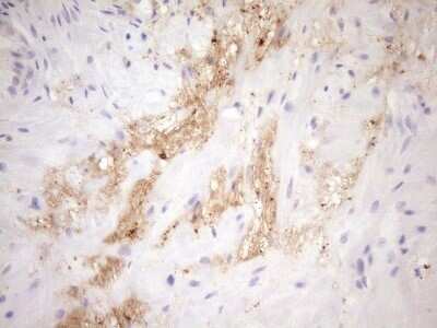 Immunohistochemistry: FGF-BP Antibody (OTI2B6) - Azide and BSA Free [NBP2-71527]