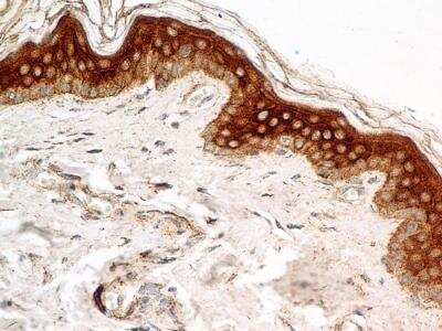Immunohistochemistry-Paraffin: FGFR1 Antibody (M17D10) - BSA Free [NB100-2080]