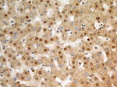 Immunohistochemistry-Paraffin: FGFR1 Antibody (M17D10) - BSA Free [NB100-2080]