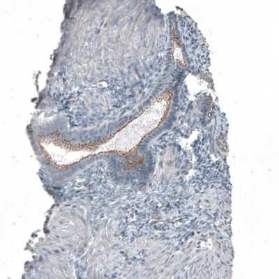 Immunohistochemistry-Paraffin: FGFR2 Antibody [NBP1-88670]