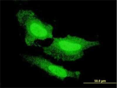 Immunocytochemistry/ Immunofluorescence: FGF acidic/FGF1 Antibody (2E12) [H00002246-M02]