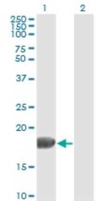 Western Blot: FGF acidic/FGF1 Antibody (2E12) [H00002246-M02]