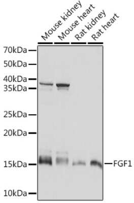 Western Blot: FGF acidic/FGF1 Antibody (3X3E5) [NBP3-16609]