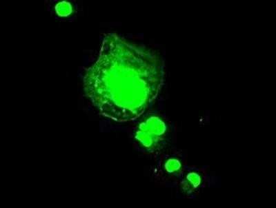 Immunocytochemistry/ Immunofluorescence: FGF acidic/FGF1 Antibody (OTI4D2) - Azide and BSA Free [NBP2-70717]