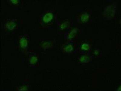 Immunocytochemistry/ Immunofluorescence: FGF basic/FGF2/bFGF Antibody (OTI3D9) [NBP1-47749]