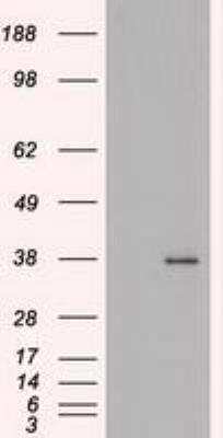 Western Blot: FGF basic/FGF2/bFGF Antibody (OTI3D9) [NBP1-47749]
