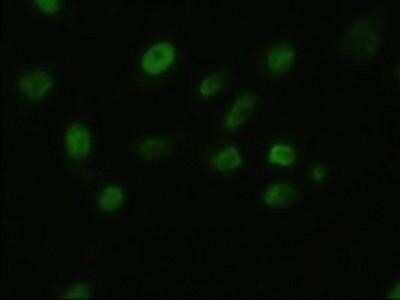 Immunocytochemistry/ Immunofluorescence: FGF basic/FGF2/bFGF Antibody (OTI3D9) - Azide and BSA Free [NBP2-70718]
