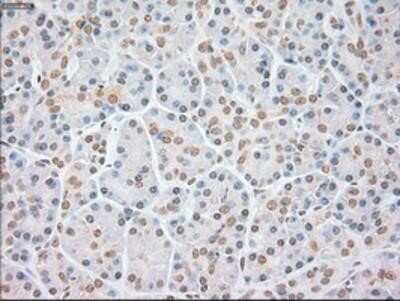 Immunohistochemistry: FGF basic/FGF2/bFGF Antibody (OTI3D9) - Azide and BSA Free [NBP2-70718]