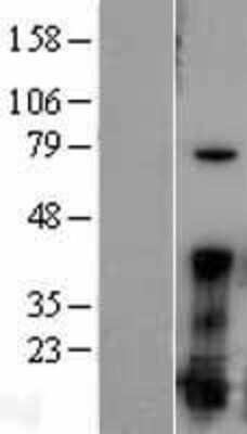 Western Blot: FGF acidic/FGF1 Overexpression Lysate [NBL1-10687]